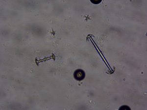 Photo of freshwater sponge (Dosilia radiospiculata) gemmoscleres.