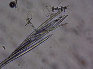 Photo of freshwater sponge (Dosilia radiospiculata) megascleres.