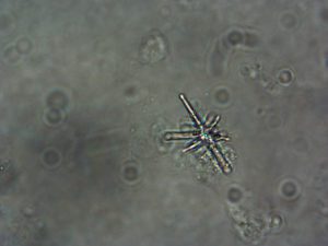 Photo of freshwater sponge (Dosilia radiospiculata) microscleres closeup view.