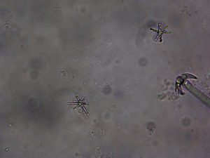 Photo of freshwater sponge (Dosilia radiospiculata) microscleres.